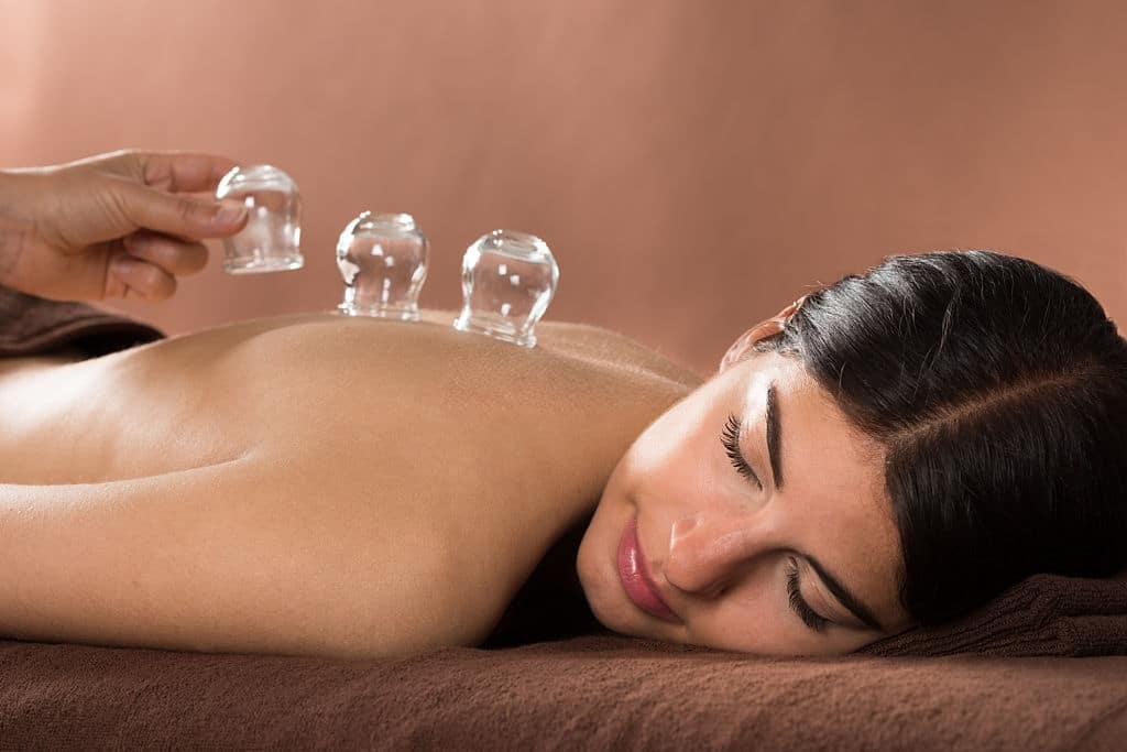 Cupping Therapy Edmonton
