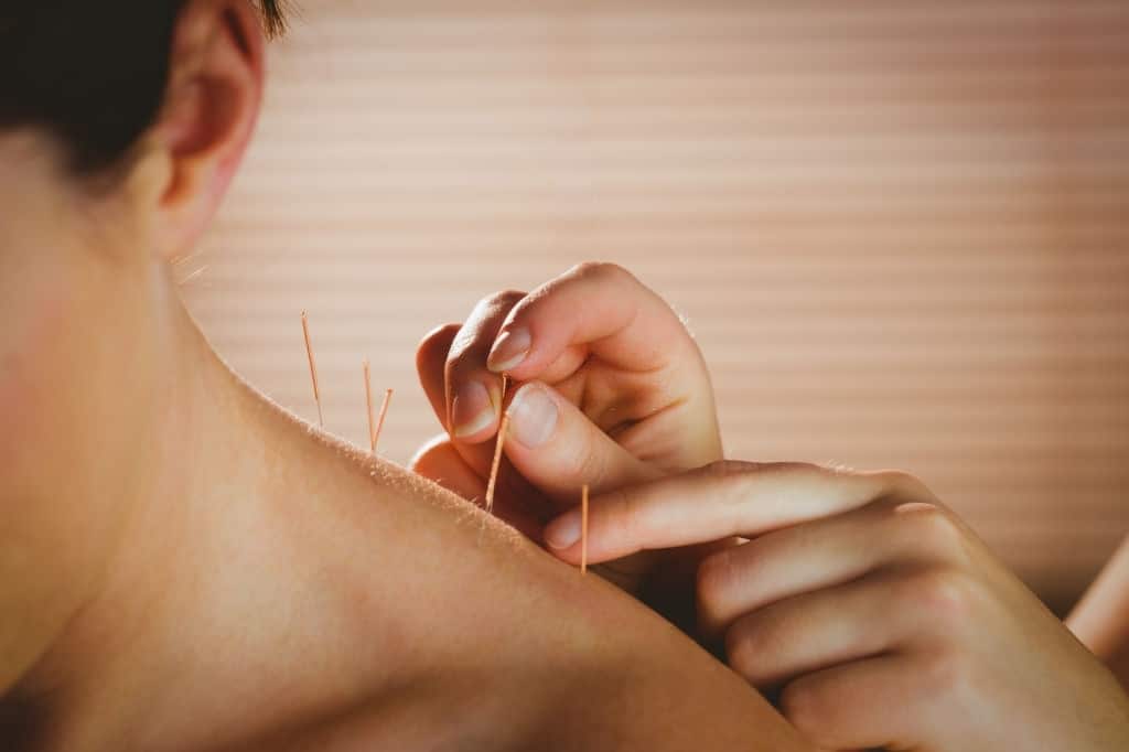 Acupuncture Therapy Edmonton