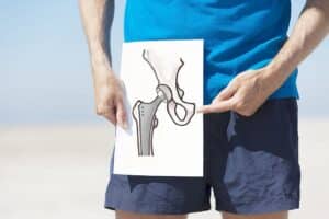 Total Joint Replacement Physiotherapy Edmonton | Family®